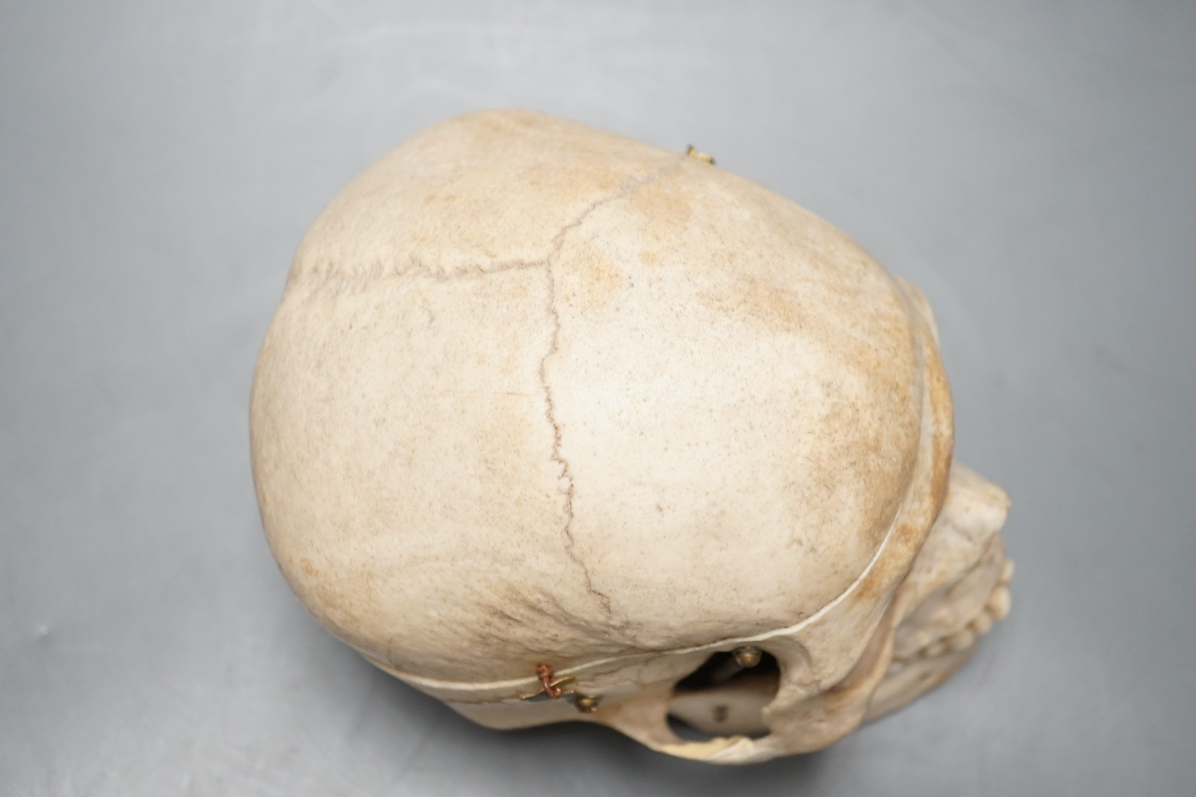 A human skull with removable cranium and spring loaded jaw 15.5cm